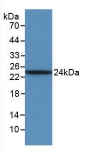 Monoclonal Antibody to Interleukin 6 (IL6)