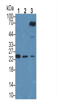 Monoclonal Antibody to Interleukin 6 (IL6)