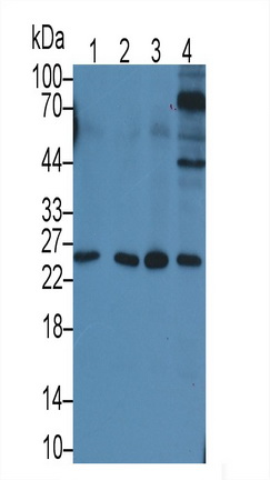 Monoclonal Antibody to Interleukin 6 (IL6)