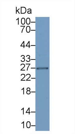 Monoclonal Antibody to Interleukin 6 (IL6)