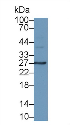 Monoclonal Antibody to Interleukin 6 (IL6)