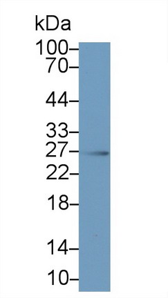 Monoclonal Antibody to Interleukin 6 (IL6)