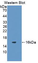 Monoclonal Antibody to Interleukin 8 (IL8)