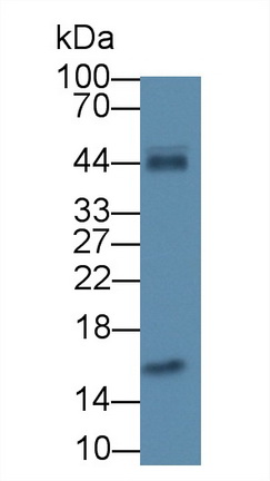 Monoclonal Antibody to Leptin (LEP)