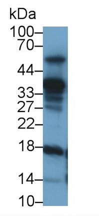 Monoclonal Antibody to Leptin (LEP)