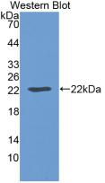 Monoclonal Antibody to Leptin (LEP)