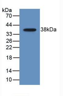 Monoclonal Antibody to Macrophage Derived Chemokine (MDC)