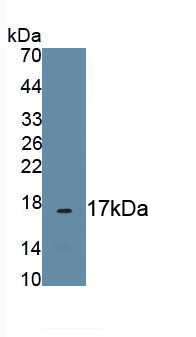 Monoclonal Antibody to Matrix Metalloproteinase 3 (MMP3)