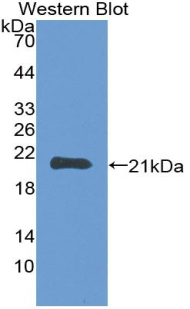 Monoclonal Antibody to Matrix Metalloproteinase 3 (MMP3)