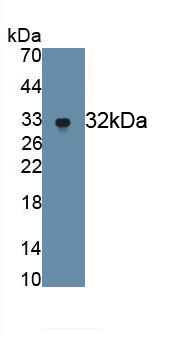 Monoclonal Antibody to Matrix Metalloproteinase 7 (MMP7)