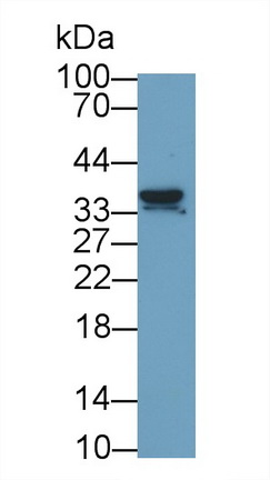 Monoclonal Antibody to Nerve Growth Factor (NGF)