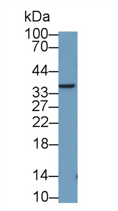 Monoclonal Antibody to Nerve Growth Factor (NGF)