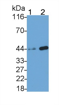 Monoclonal Antibody to Creatine Kinase, Muscle (CKM)