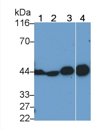 Monoclonal Antibody to Creatine Kinase, Muscle (CKM)