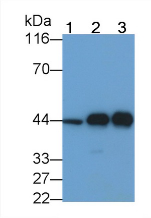 Monoclonal Antibody to Creatine Kinase, Muscle (CKM)