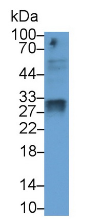 Monoclonal Antibody to Superoxide Dismutase 3, Extracellular (SOD3)