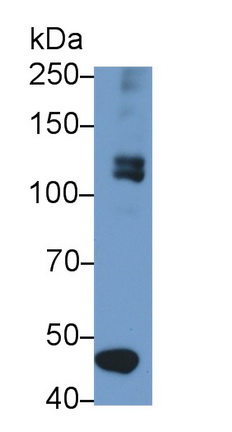 Monoclonal Antibody to Stem Cell Factor Receptor (SCFR)