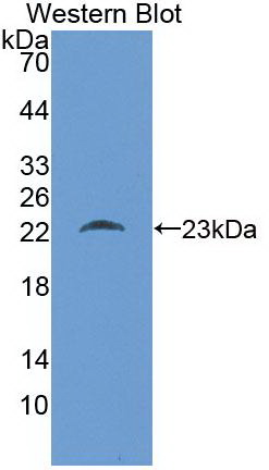 Monoclonal Antibody to Stem Cell Factor Receptor (SCFR)