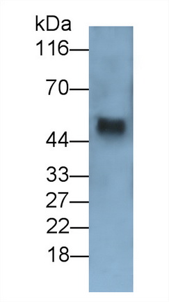 Monoclonal Antibody to Transforming Growth Factor Beta 1 (<b>TGFb1</b>)