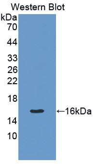 Monoclonal Antibody to Transforming Growth Factor Beta 1 (TGFb1)