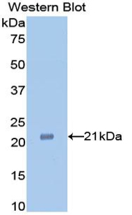 Monoclonal Antibody to Tumor Necrosis Factor Alpha (TNFa)