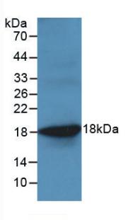 Monoclonal Antibody to Tumor Necrosis Factor Alpha (TNFa)