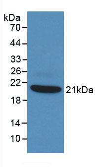 Monoclonal Antibody to Tumor Necrosis Factor Alpha (TNFa)