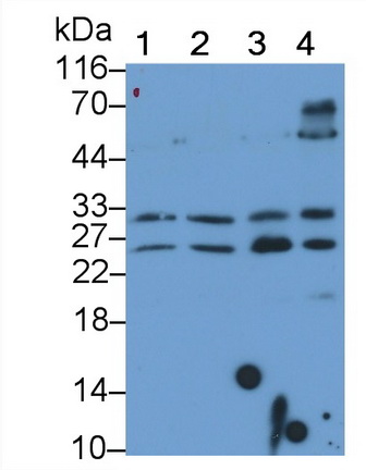 Monoclonal Antibody to Tumor Necrosis Factor Related Apoptosis Inducing Ligand (TRAIL)