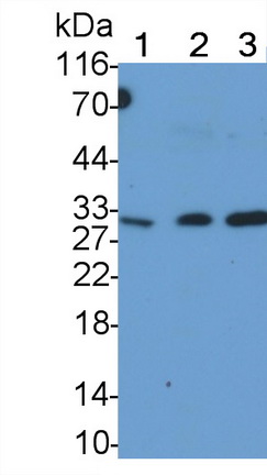 Monoclonal Antibody to Tumor Necrosis Factor Related Apoptosis Inducing Ligand (TRAIL)