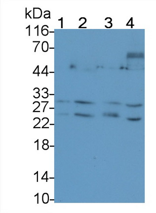 Monoclonal Antibody to Tumor Necrosis Factor Related Apoptosis Inducing Ligand (TRAIL)