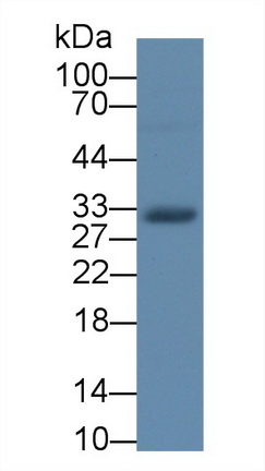 Monoclonal Antibody to Plasminogen Activator, Urokinase Receptor (uPAR)