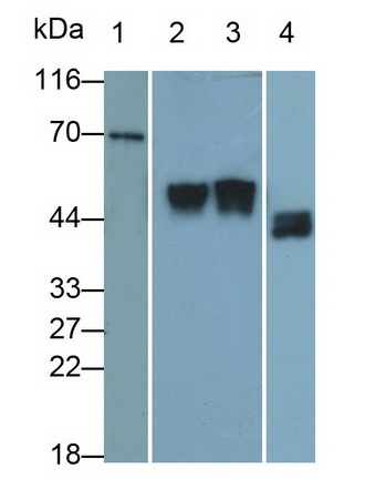 Monoclonal Antibody to Plasminogen Activator, Urokinase Receptor (uPAR)