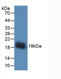 Monoclonal Antibody to Vascular Endothelial Growth Factor A (VEGFA)