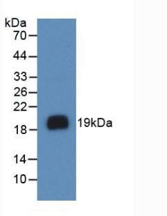 Monoclonal Antibody to Vascular Endothelial Growth Factor A (VEGFA)