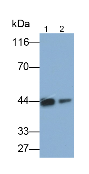 Monoclonal Antibody to Vascular Endothelial Growth Factor A (VEGFA)