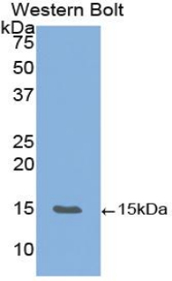 Monoclonal Antibody to Vascular Endothelial Growth Factor B (VEGFB)