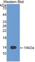 Monoclonal Antibody to Vascular Endothelial Growth Factor D (VEGFD)