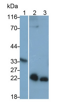 Monoclonal Antibody to Prostate Specific Antigen (PSA)