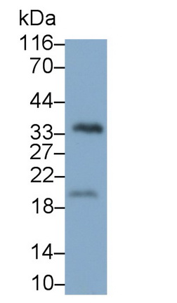 Monoclonal Antibody to Prostate Specific Antigen (PSA)