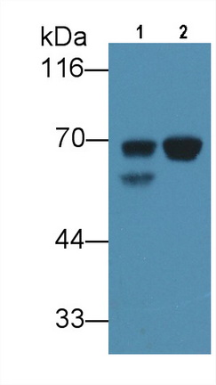 Monoclonal Antibody to Alpha-Fetoprotein (AFP)