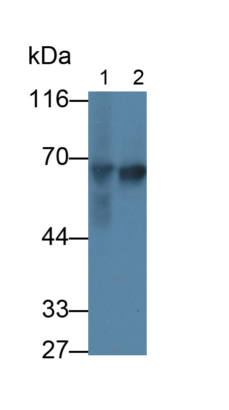 Monoclonal Antibody to Alpha-Fetoprotein (AFP)