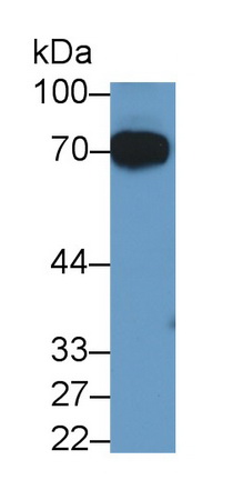 Monoclonal Antibody to Alpha 2-Antiplasmin (a2PI)