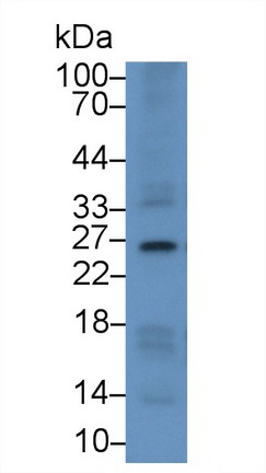 Monoclonal Antibody to Ubiquitin (Ub)