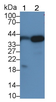 Monoclonal Antibody to Pepsinogen A (PGA)