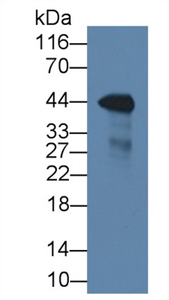 Monoclonal Antibody to Pepsinogen A (PGA)