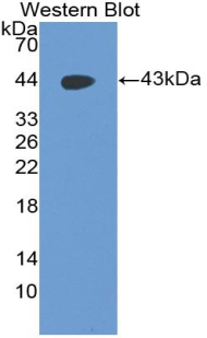 Monoclonal Antibody to Pepsinogen A (PGA)