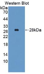 Monoclonal Antibody to Alanine Aminotransferase (ALT)