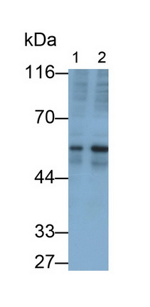 Monoclonal Antibody to Transforming Growth Factor Beta 2 (TGFb2)