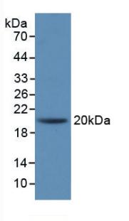 Monoclonal Antibody to Interleukin 1 Receptor Antagonist (IL1RA)