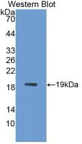 Monoclonal Antibody to Interleukin 1 Receptor Antagonist (IL1RA)